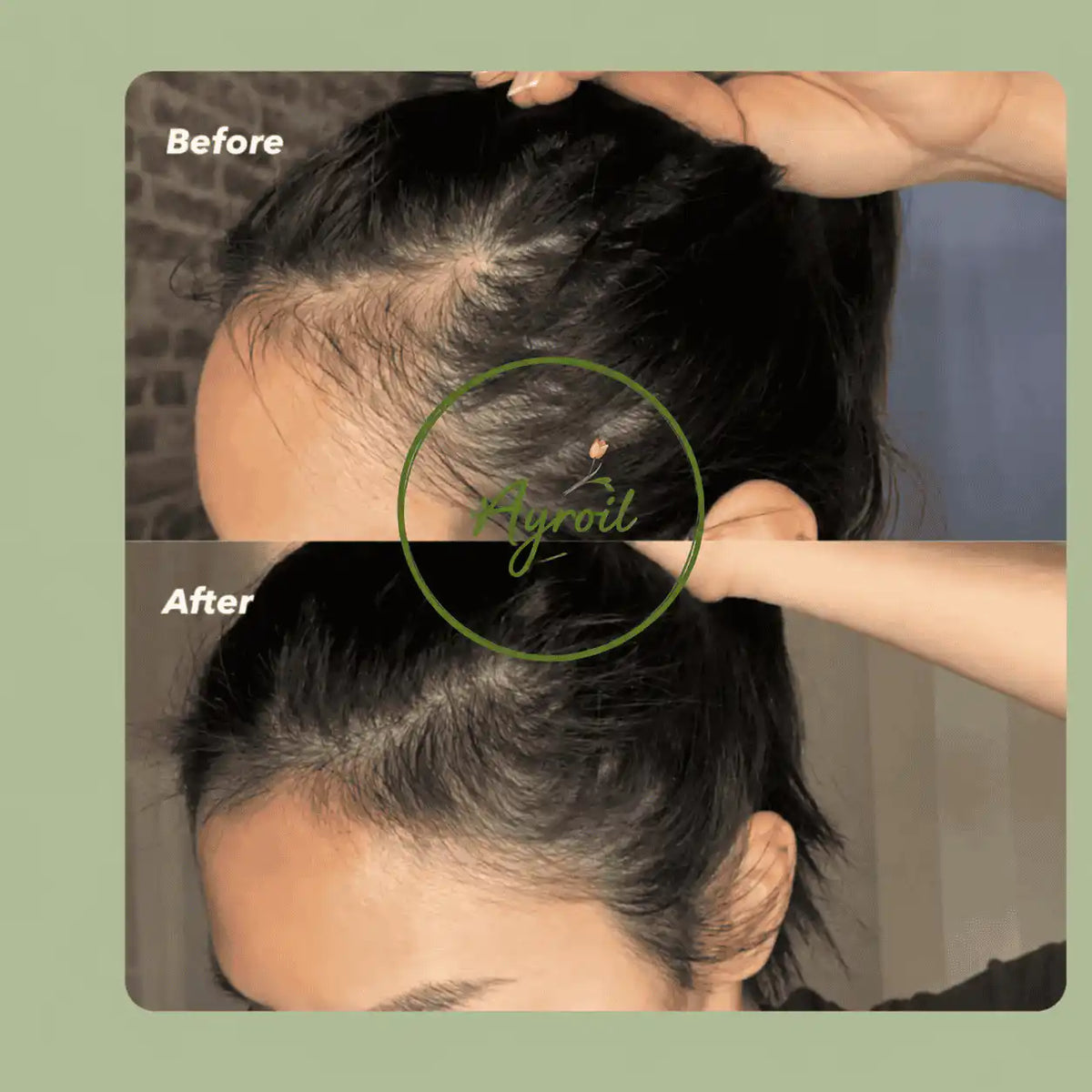 Ayroil Nourishing Hair Oil - 180ml