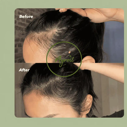 Ayroil Nourishing Hair Oil - 180ml